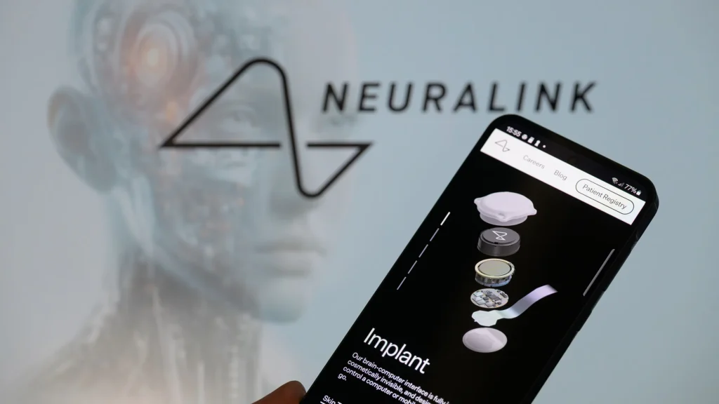 Neuralink Telepathy 2026: первый коммерческий интерфейс BCI
